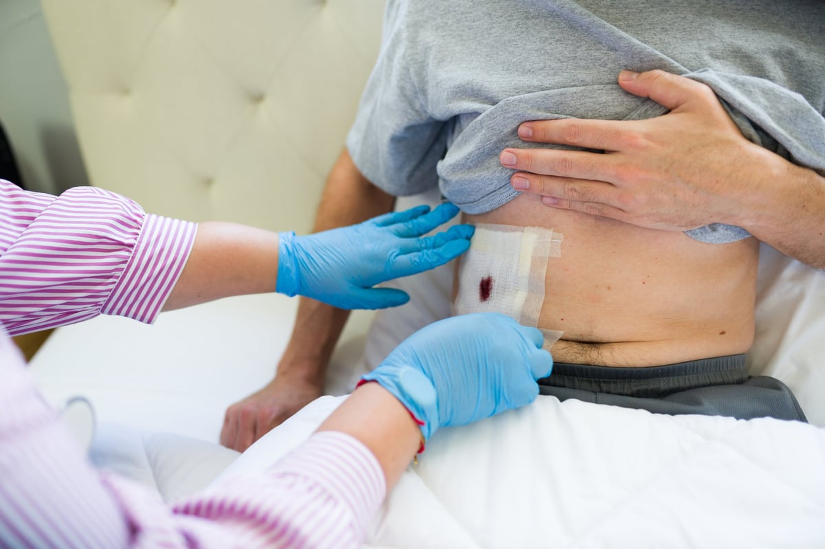 A nurse changing a surgical bandage for a patient recovering comfortably at home