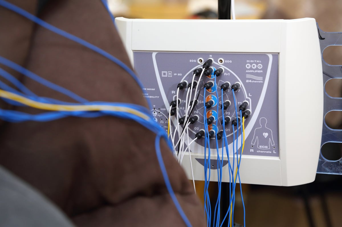 Electroencephalography (EEG) procedure measuring the brain's electrical activity
